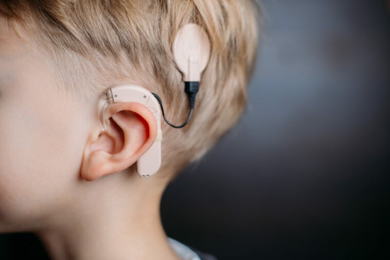 Cochlear Implants &#8211; Three Misunderstandings, Audiologist.co.uk