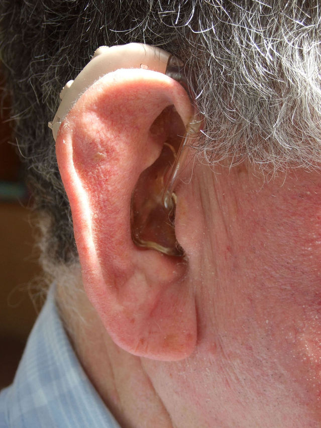 hearing aid in birmingham